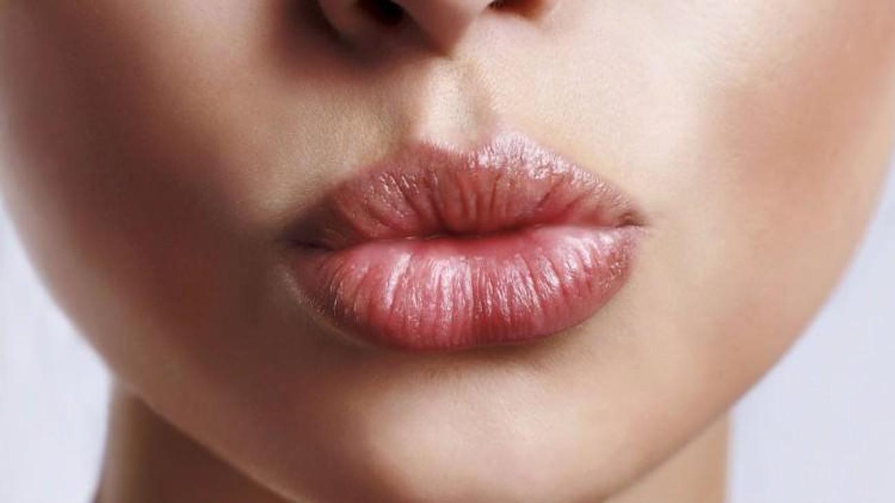 dudak catlamasi neden olur dudak catlamasina bitkisel cozumler saglik haberleri
