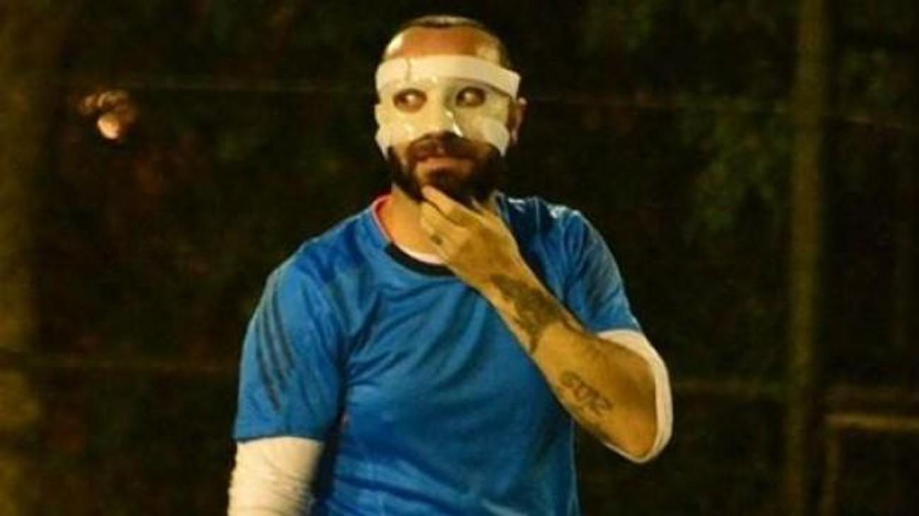 arda nin burnunu kirdigi berkay in son hali tum spor haber