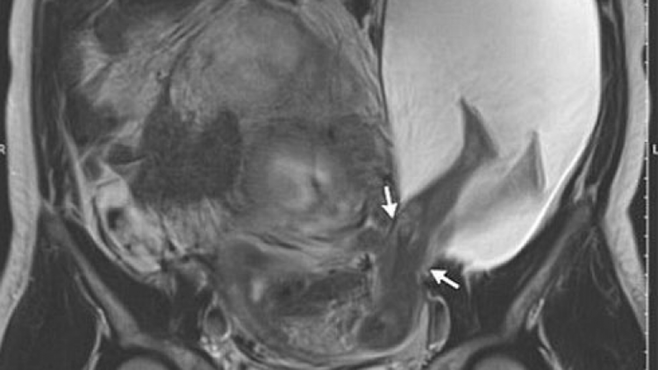 Dünyada sadece 26 kişide görüldü! Anne/Çocuk Haberleri