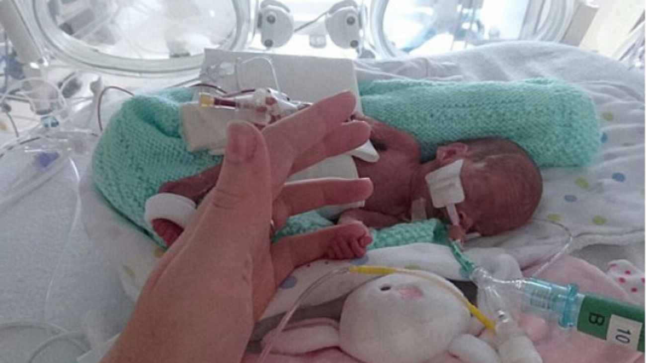 23 haftalık bebek ilki başardı! Yaşam Haberleri