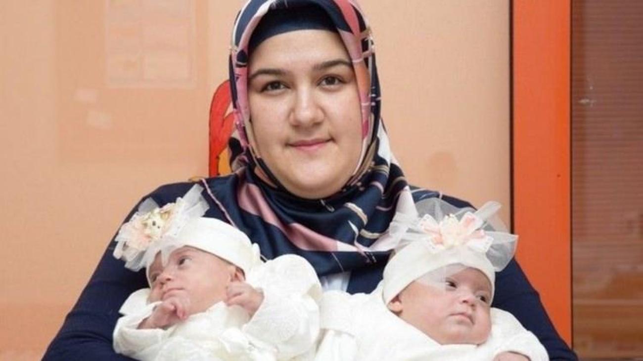 Mucize bebek zorlu yaşam mücadelesini kazandı Yaşam