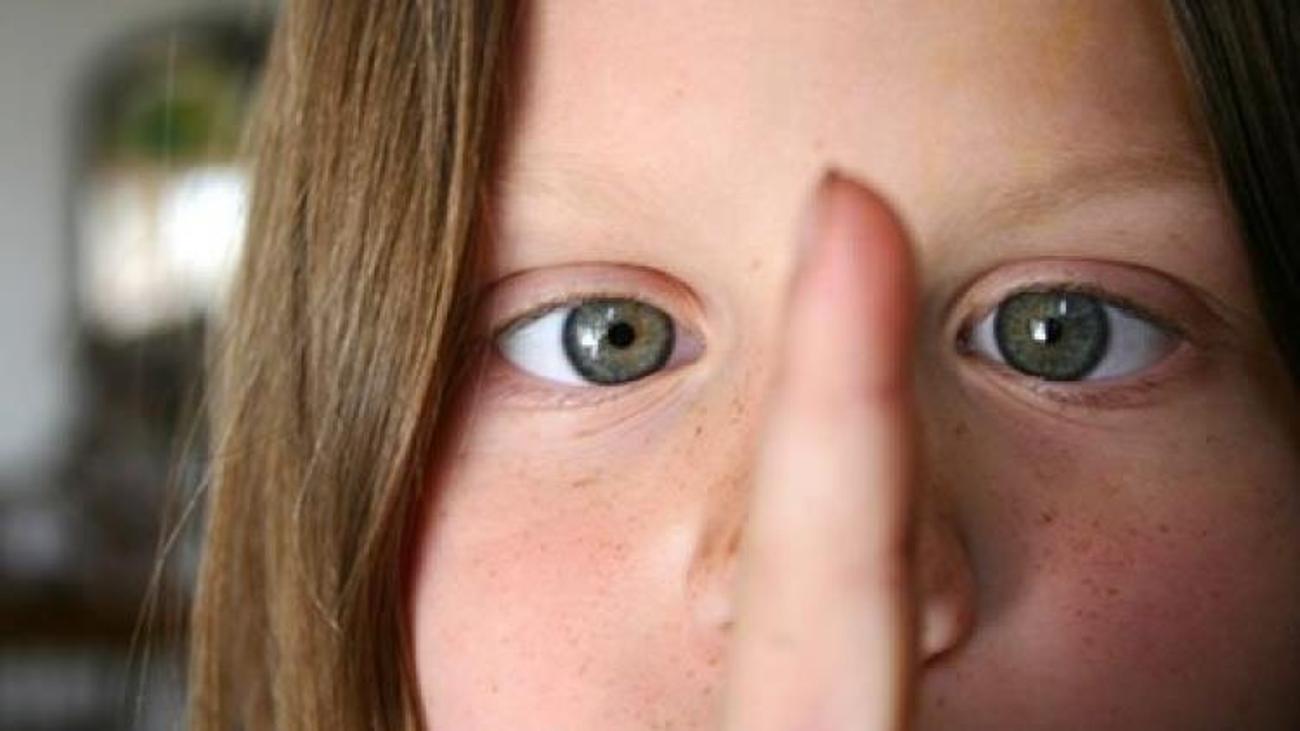 Причины появления косоглазия. Косоглазие у детей фото. Косоглазие у детей что это. Сходящееся косоглазие у новорожденных. Косоглазие причины.