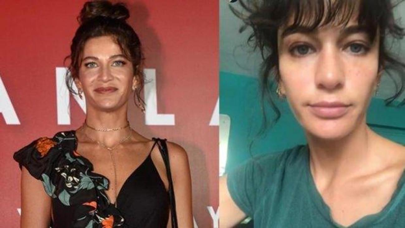 Berrak Tüzünataç�tan korkutan paylaşım! Magazin Haberleri