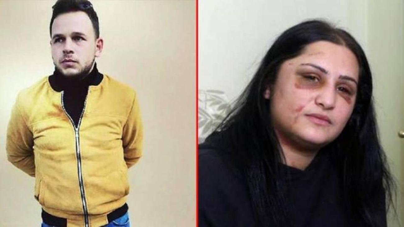 Eski eşi tarafından darp edilen şiddet mağduru kadın ilk