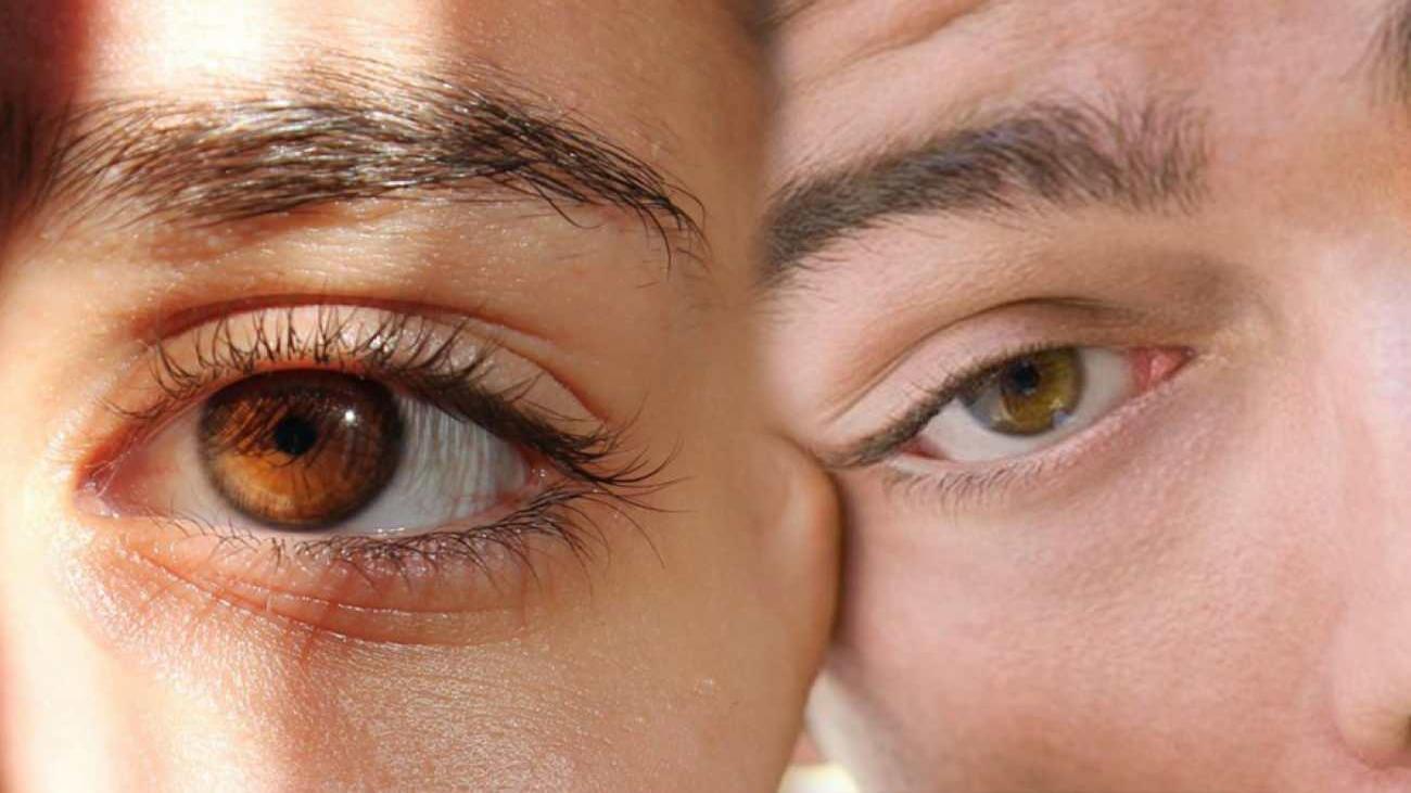 Göz seyirmesi ne anlama gelir? Sağ ve sol göz seğirmesi neden olur? Göz