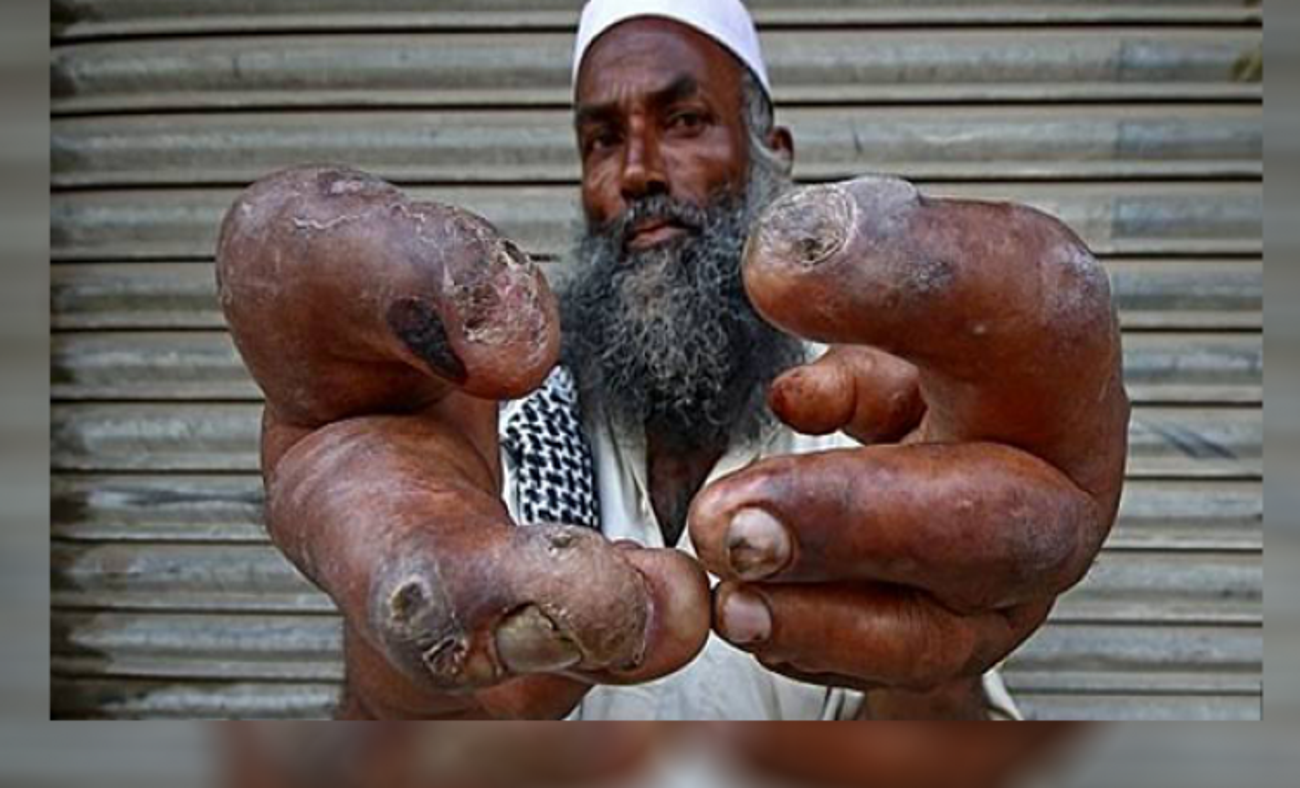 Dev elleri y&uuml;z&uuml;nden iş bulamıyor!