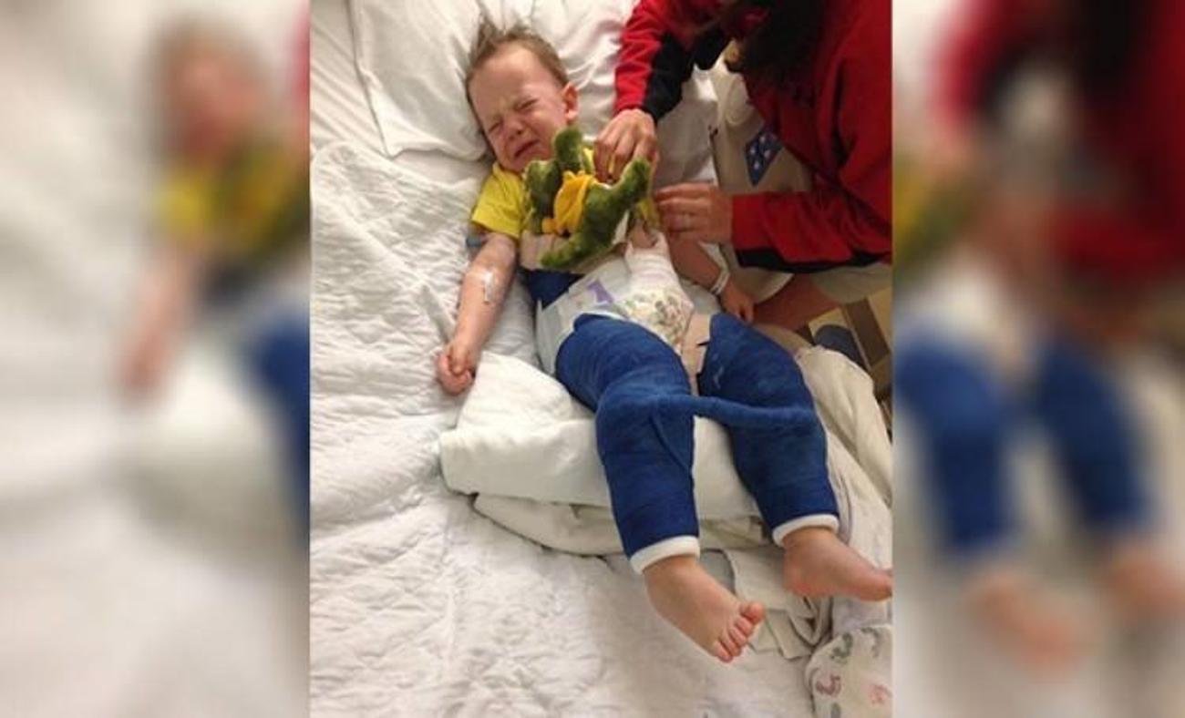 Trambolin 3 yaşındaki çocuğun kalçasını kırdı