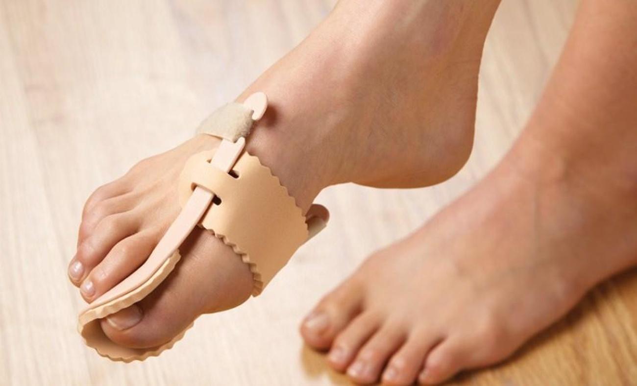 Ayak parmak bozukluğu ve ayak baş parmağındaki kemik çıkıntısı nedir? 
