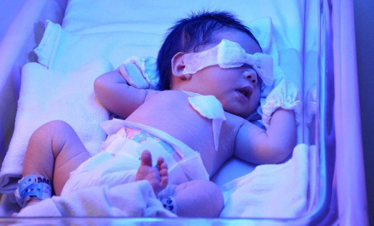 Yenidogan Sariligi Nedir Bebeklerde Sarilik Evde Nasil Gecer Bebeklerde Sarilik Derecesi Bebek Haberleri