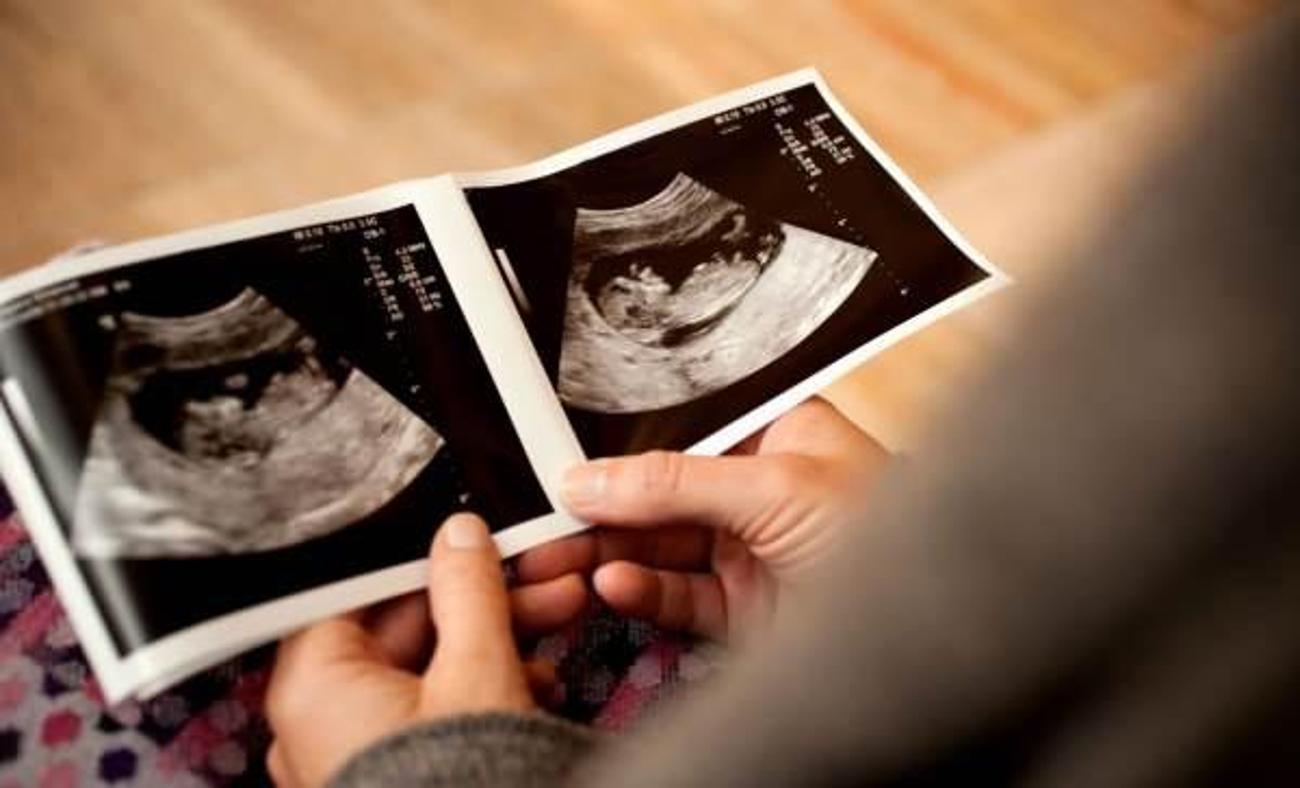 Ultrasonda bebeğin cinsiyetini göstermemesi! Kız ve erkek bebek ultrasonda nasıl görünür?