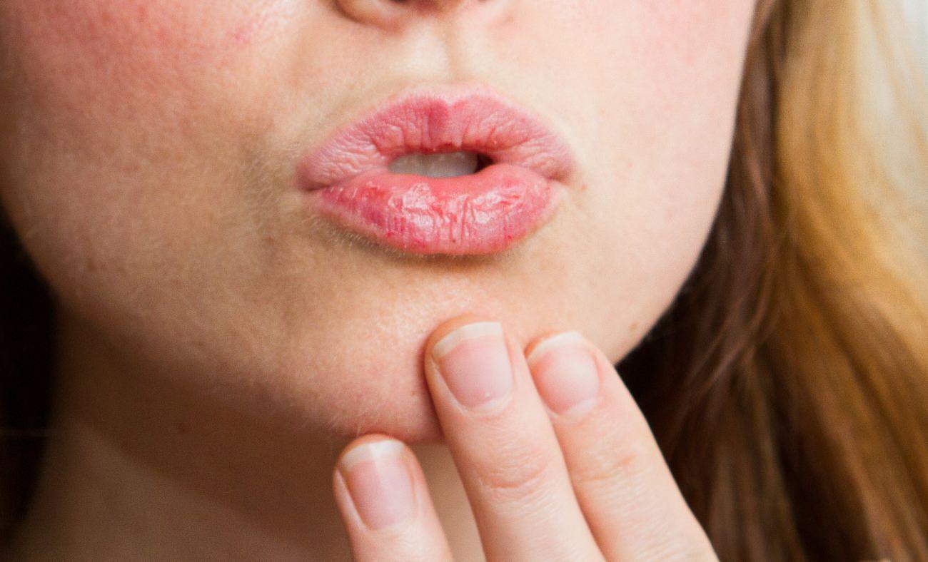 Evde dudak bakımı nasıl yapılır? 4 adımda kolayca kuru dudak bakımı