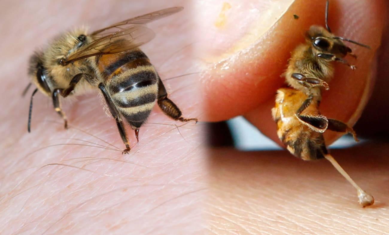Arı alerjisi nedir ve belirtileri nelerdir? Arı sokmasına iyi gelen doğal yöntemler