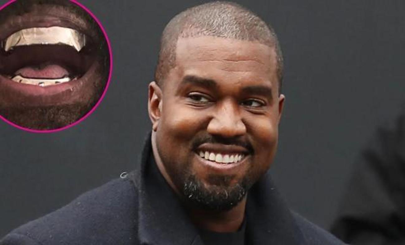 Kanye West tüm dişlerini çektirip titanyumla kaplattı! Eşi bu haline resmen bayıldı