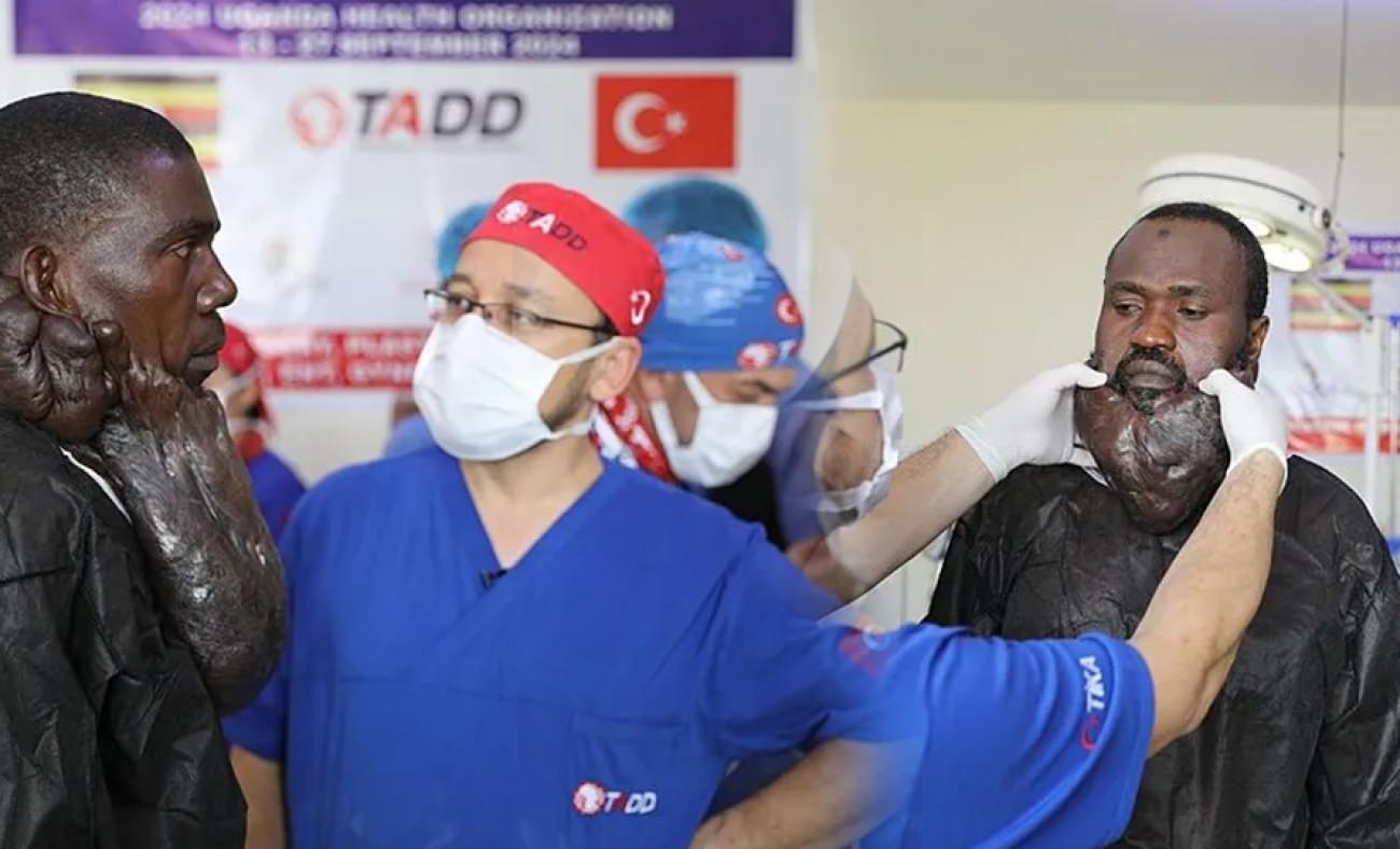 Sakaldan da uzundu! Yüzündeki kitleden Türk doktorları kurtardı!