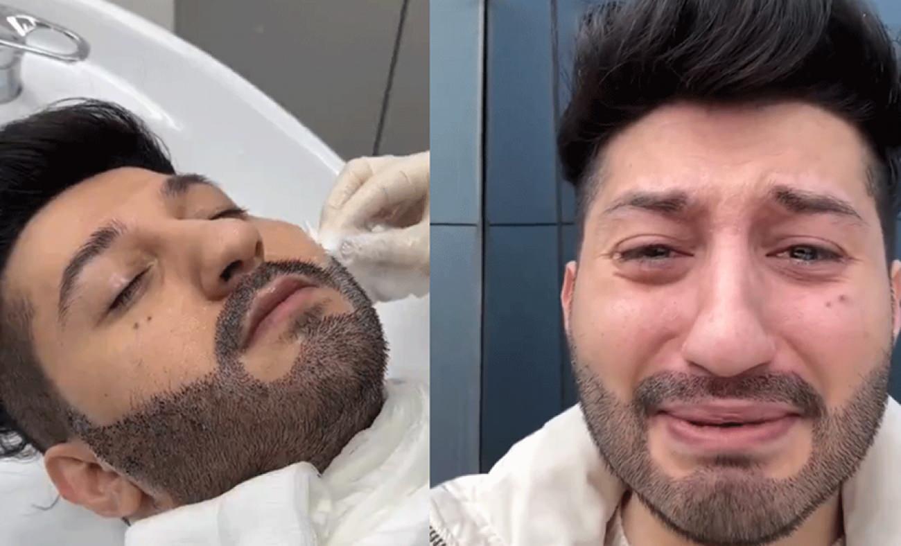 Sakal ektiren adam kabus yaşadı! Sonucu görünce gözyaşlarına boğuldu