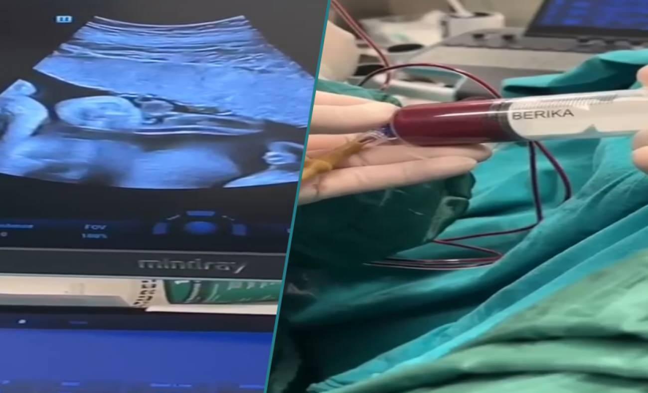 Anne karnındaki bebeğe kan nakli yapıldı