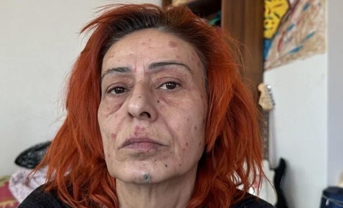 Yıldız Tilbe ilk kez hastalığını açıkladı! Doktorunun yasağı şaşırttı
