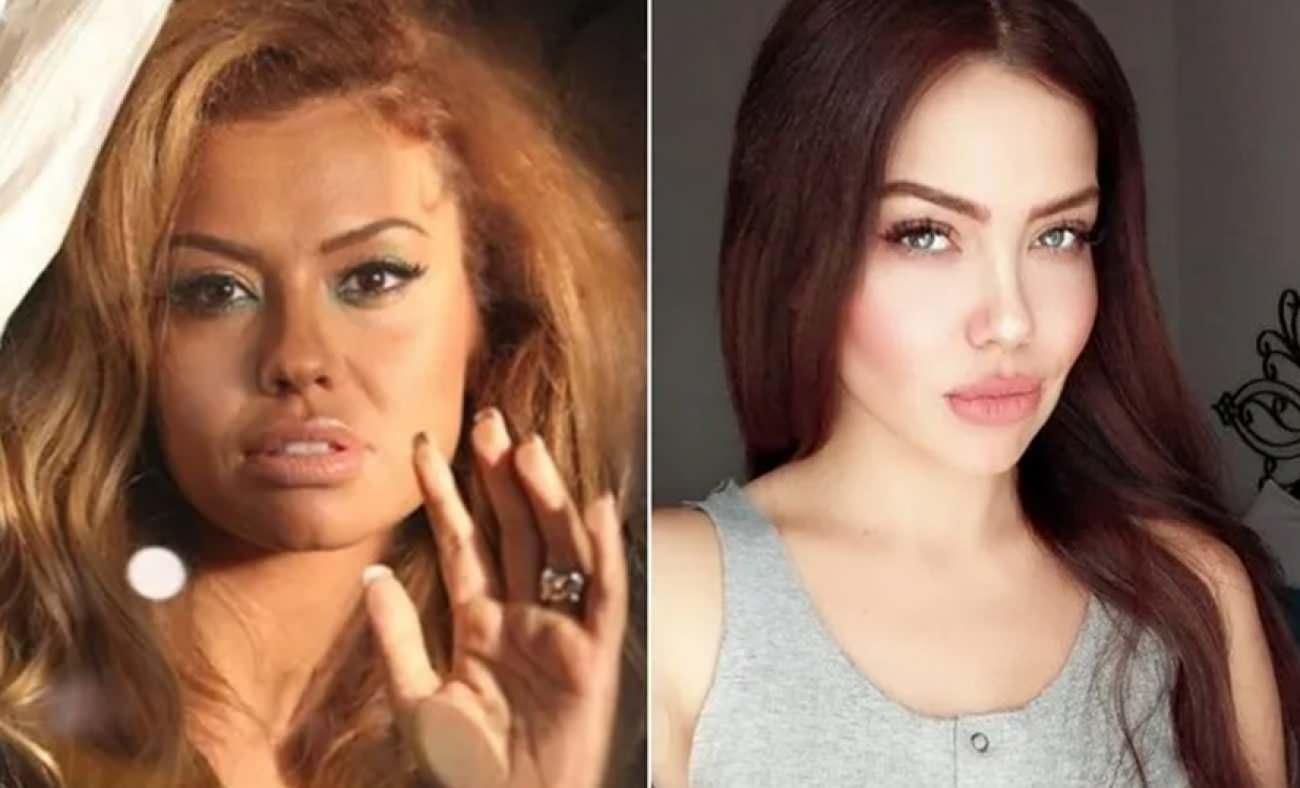 Ünlü şarkıcı Lara'dan üzen haber: Beynimde kitle belirlendi Allah'ın izniyle bu sınav bitecek!