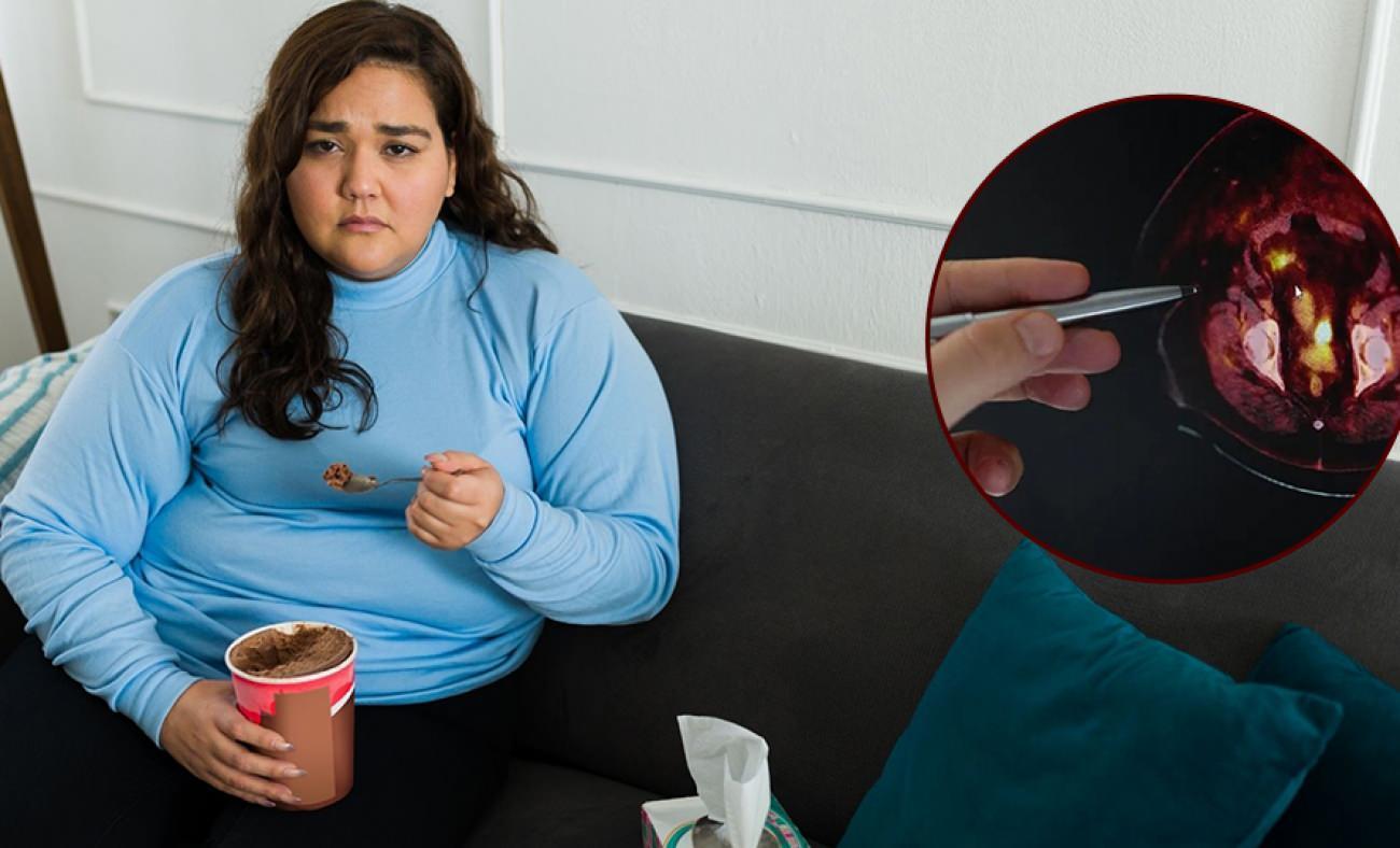 Uzman isim uyardı: Obezitenin gölgesinde gözden kaçan 'kanser' tehdidi!