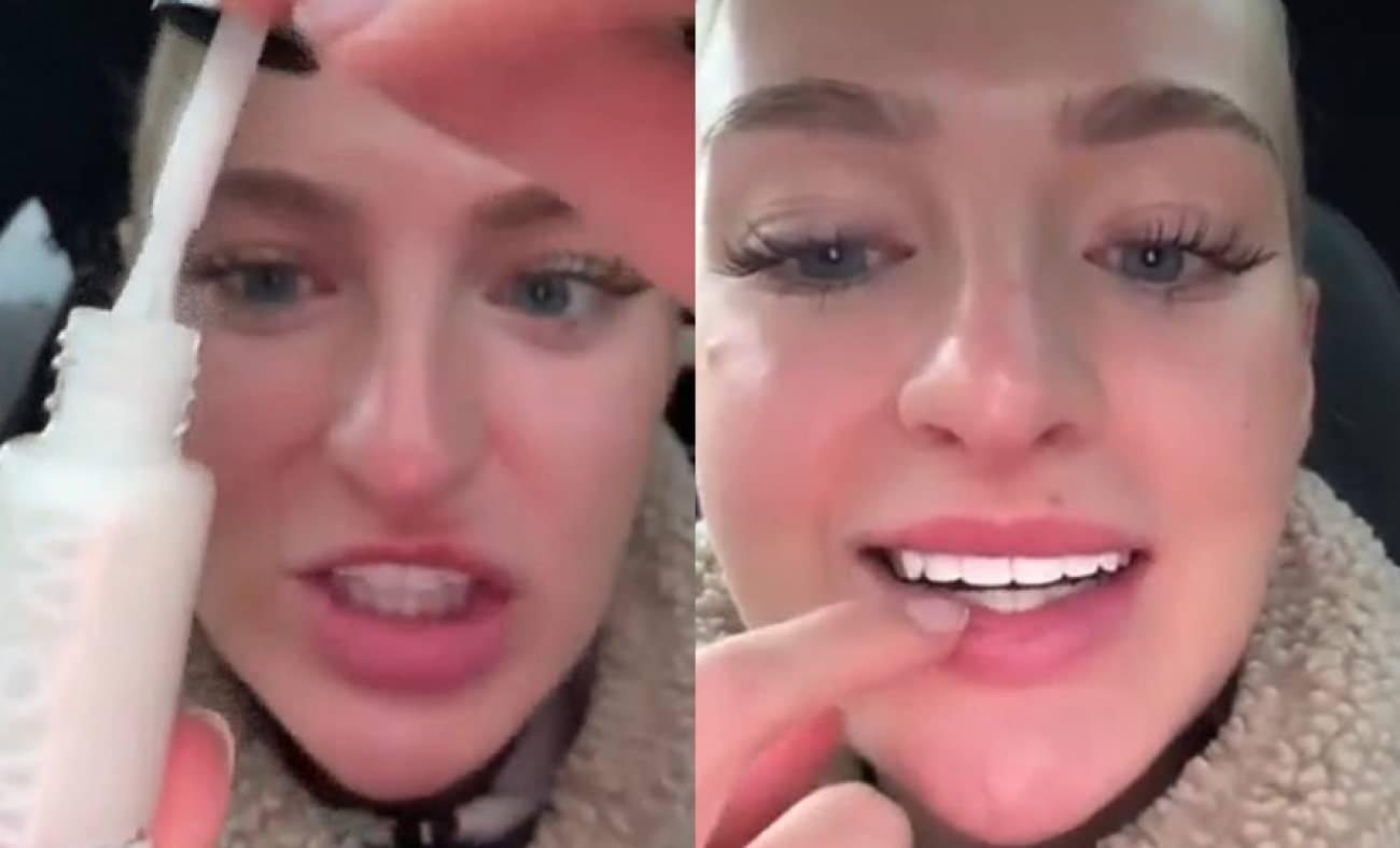 Dişlerini beyazlatmak isteyen kadının kullandığı yöntem 'yok artık' dedirtti!