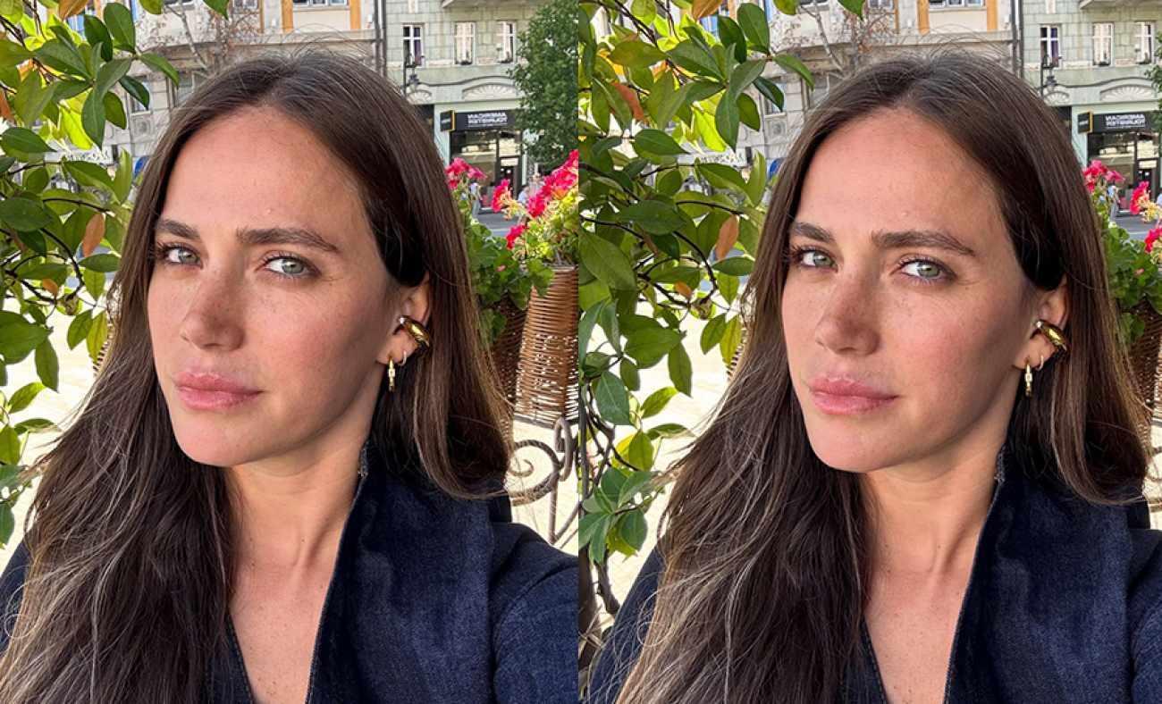 Amerika'da yaşayan Ceyda Ateş sağlık sorununu anlattı! Takipçilerinde yardım istedi