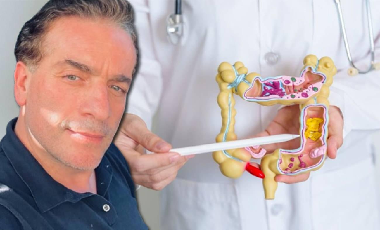 Murat Cemcir'i yoğun bakımlık eden hastalık divertikül kanaması nedir?