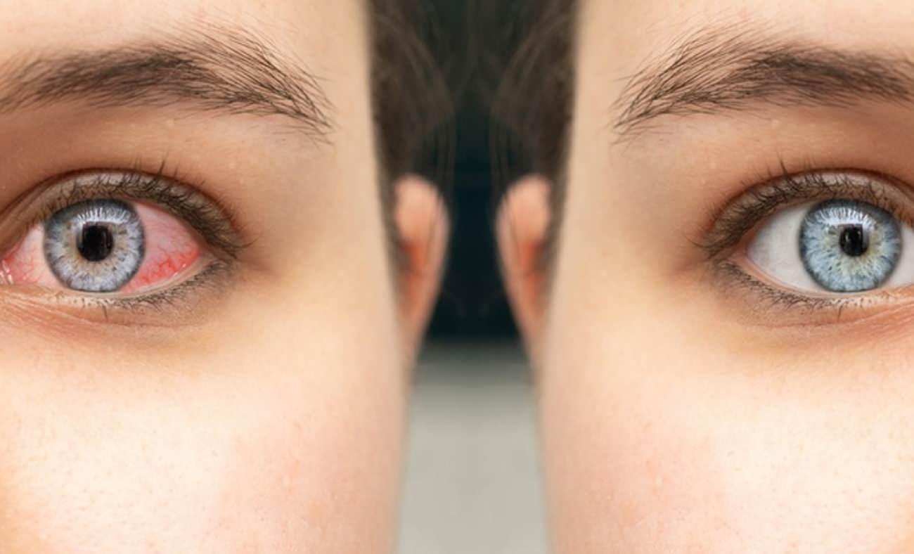 Uzmanı uyarıyor: Kış aylarında soğuk hava ve kapalı ortamlar, göz sağlığını tehdit ediyor!