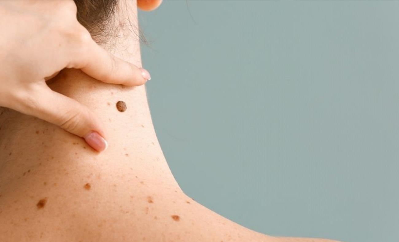 Uzman isim a&ccedil;ıkladı: &Ccedil;ocuklarda benler masum mu, risk sinyali mi? 