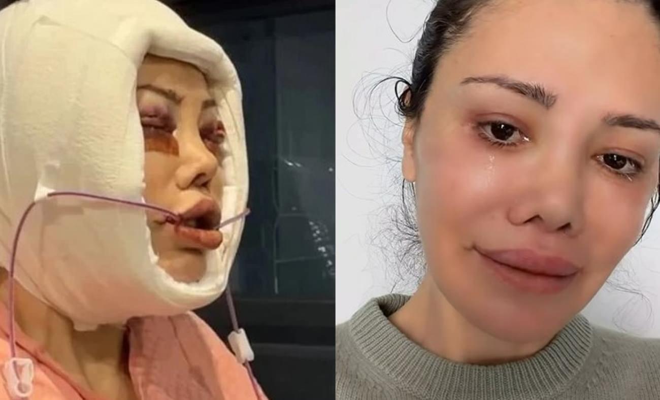 Y&uuml;z nakli ge&ccedil;irmişti! Didem Ceran k&ouml;t&uuml; haberi duyurdu