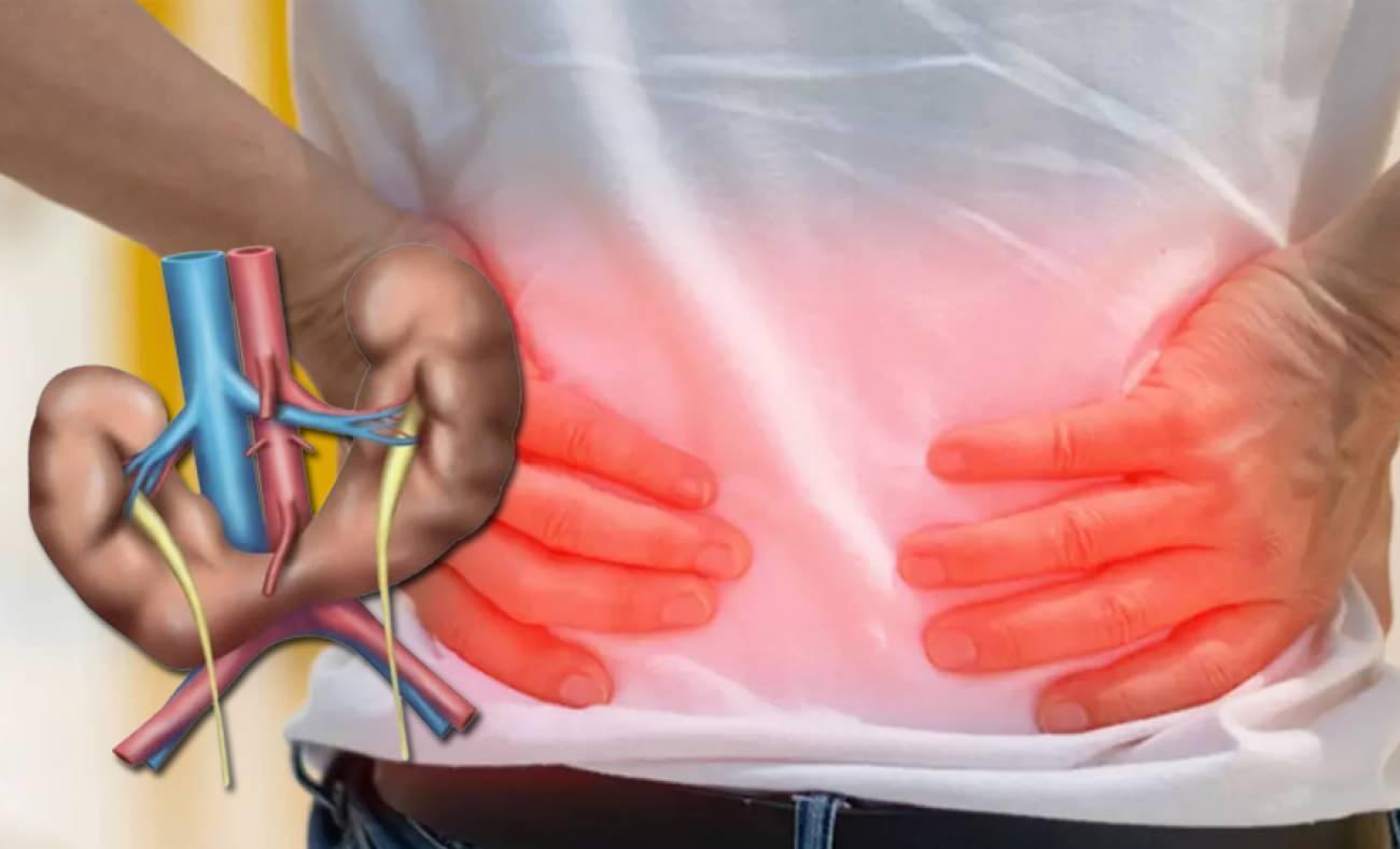 At nalı b&ouml;brek: Her 400 doğumda g&ouml;r&uuml;len belirti vermeyen b&ouml;brek anomalisi ve riskleri