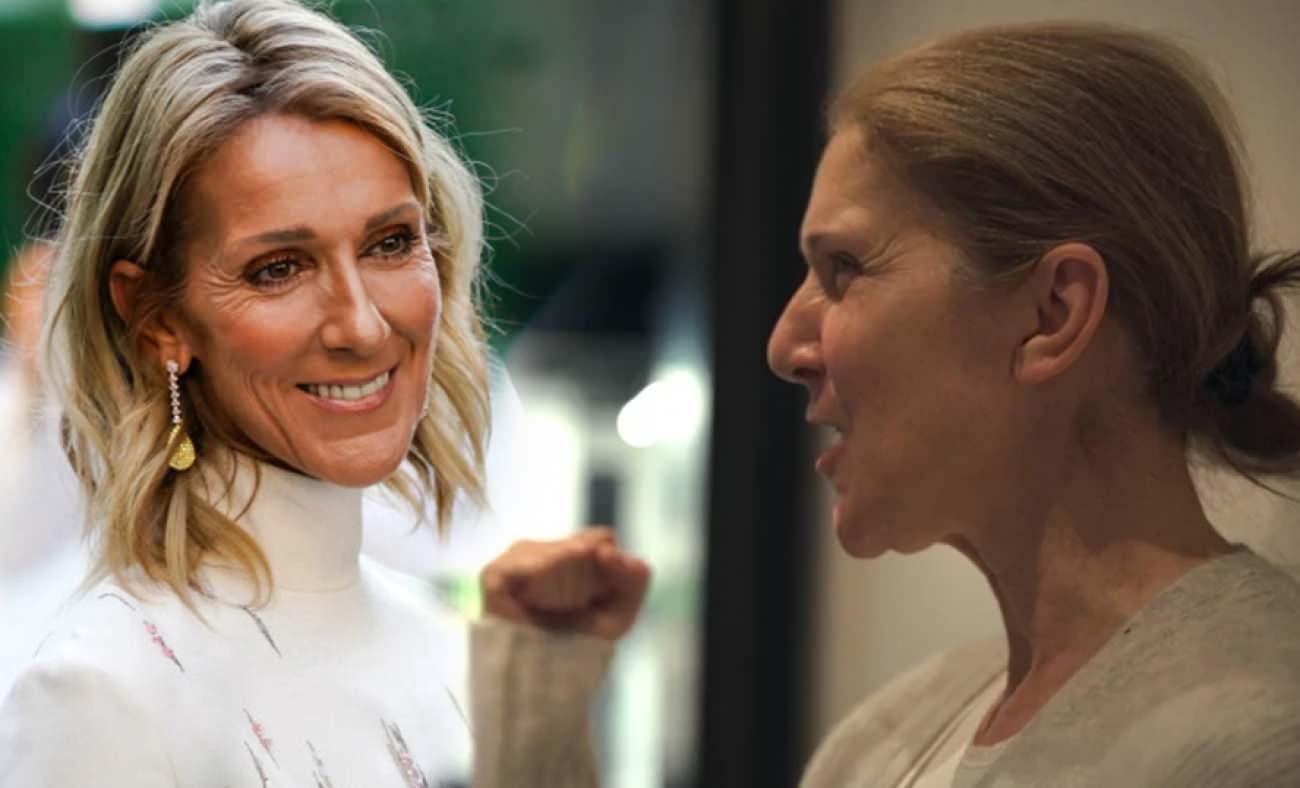 Tedavisi olmayan nadir hastalıkla m&uuml;cadele ediyor: Celine Dion yıllar sonra sahnelere d&ouml;necek!