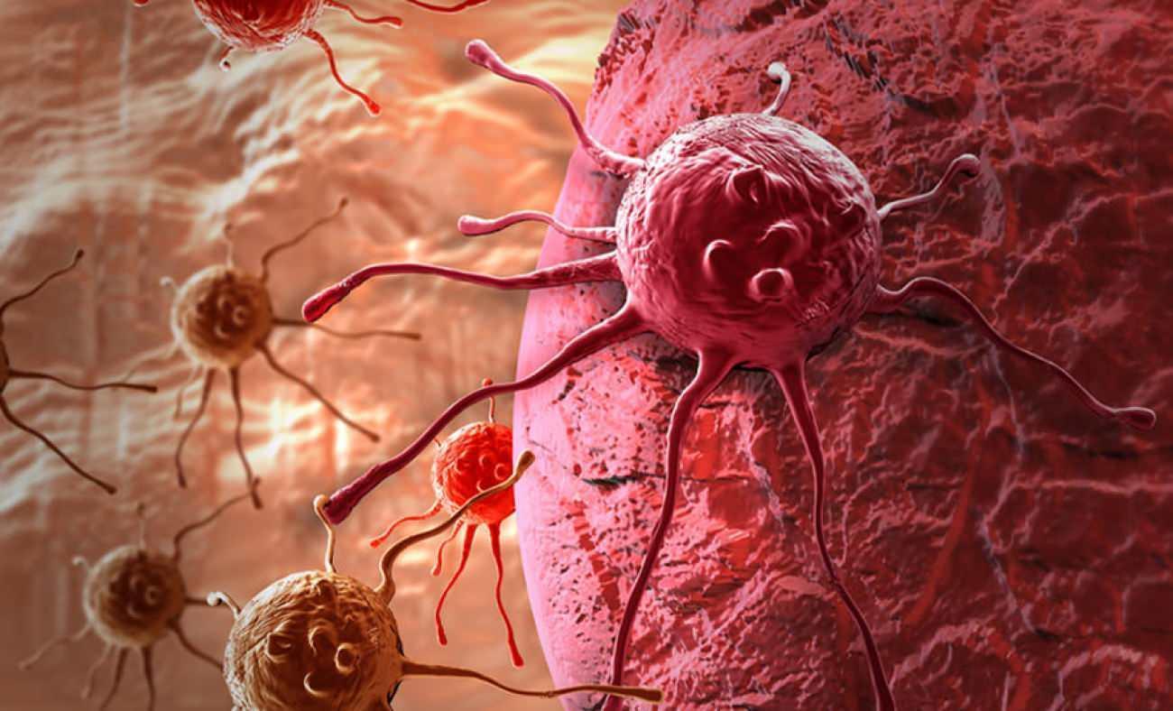 V&uuml;cudunuzun sessiz uyarıları: Kanser &ouml;ncesi belirtileri g&ouml;z ardı etmeyin!