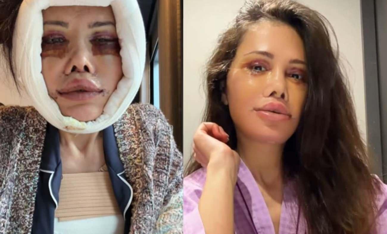 Kore'de y&uuml;z nakli ge&ccedil;irmişti! Didem Ceran'ın y&uuml;z&uuml; ile ilgili sorduğu soru g&uuml;ndem oldu