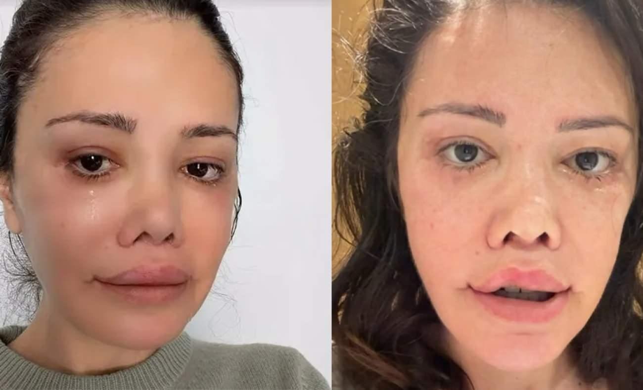 Y&uuml;z nakli olan Didem Ceran'ın gen&ccedil;lik sırrı yumurta &ccedil;ıktı!