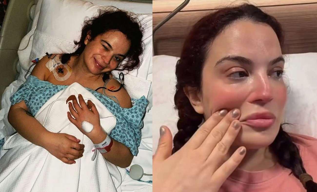 7. kez ameliyat masasına yatmıştı! Aslı Bekiroğlu: Bedenim deforme olduğu i&ccedil;in mutsuzum