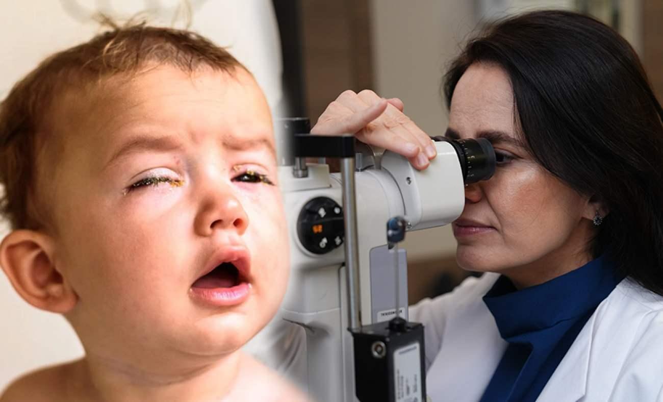 Uzmanı a&ccedil;ıkladı: Bu masaj g&ouml;zyaşı kanalı tıkanıklığını a&ccedil;abiliyor
