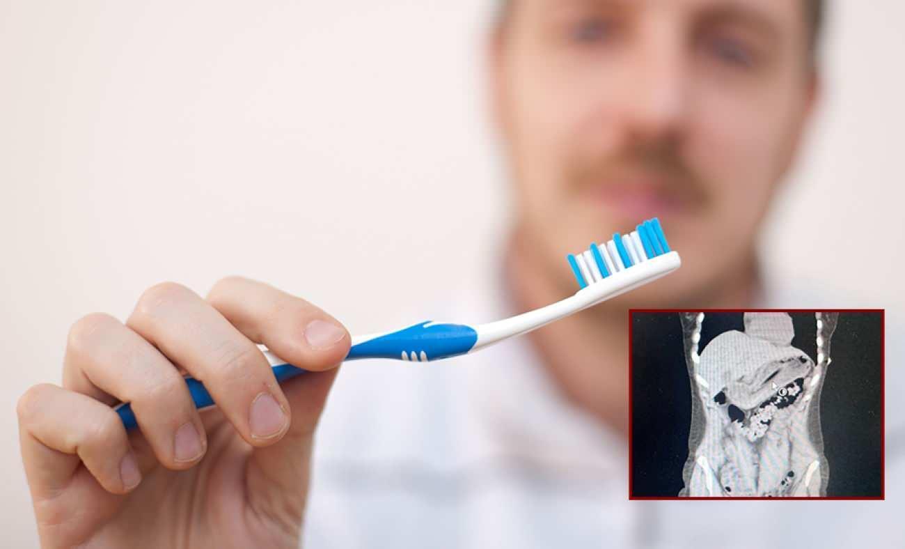 Zayıflamak isterken diş fır&ccedil;asını yuttu! Doktorlar bile şaşkına uğradı 