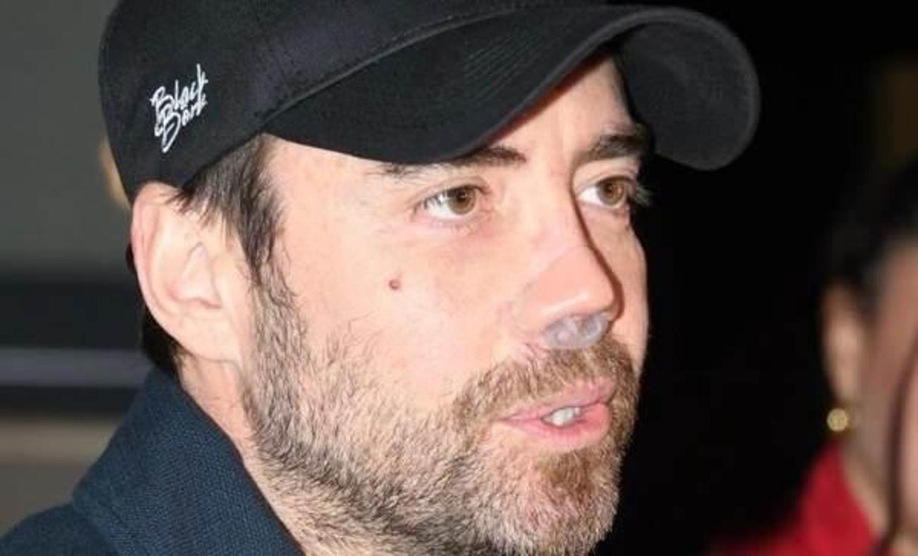 "Doktorlar hi&ccedil; şans vermiyordu!" Murat Dalkılı&ccedil; iyileşemeyen burnu ile zor g&uuml;nler yaşıyor
