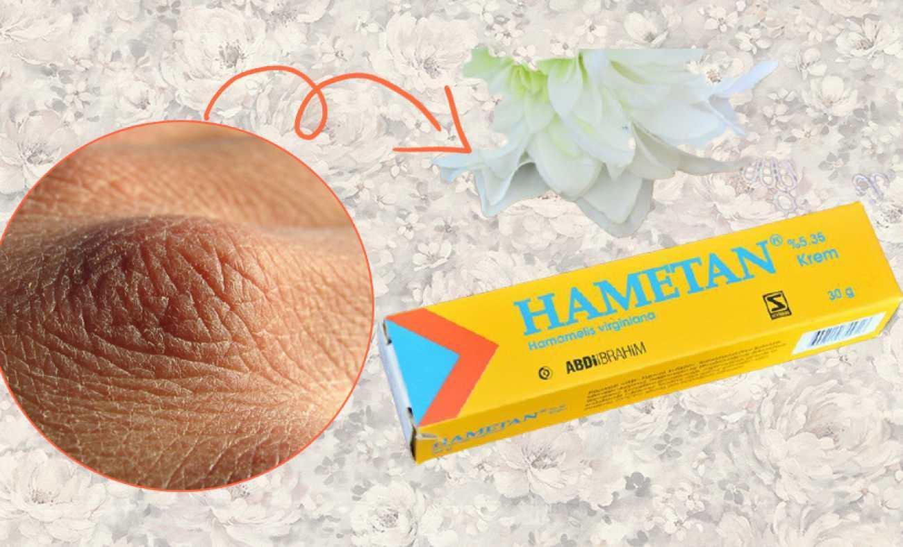 Hametan krem ne işe yarar? Hametan krem evde kullanımı! Hametan ...