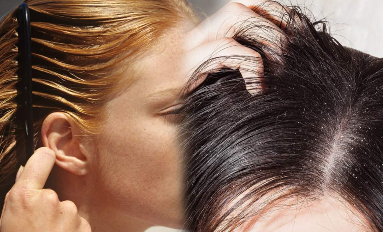 Saç neden yağlanır? Yazın saç yağlanmasını önleyen yöntemler - Güzellik