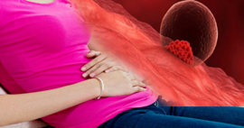 Hamilelikte İmplantasyon kanaması nedir? Yerleşme kanaması ile adet kanaması nasıl ayırt edilir