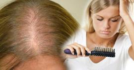 Saç dökülmesine karşı en etkili yöntem nedir? Saç dökülmesini durduran maske tarifleri