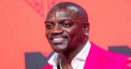 American singer Akon also preferred Turkey for hair transplant!  Here's the price he paid...