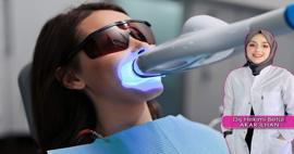 Diş beyazlatma (Bleaching)  yöntemi nasıl yapılır? Bleaching yöntemi dişlere zarar verir mi?