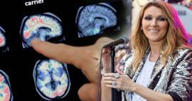 Katı kişi sendromu (stiff-person sendromu) nedir? Celine Dion'un hastalığı nedir?