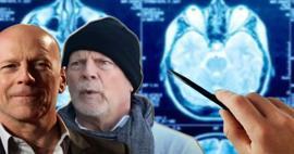 Bruce Willis'in hastalığıyla Hollywood sarsıldı!Frontotemporal demans nedir?Demans hastalığı...