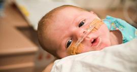 O istatistik korkuttu! Yeni doğan bebeklerin yüzde 10'u prematüre doğuyor
