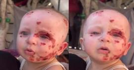 Ailesinin yüzüne bakmaya kıyamadığı Mira bebek İsrail saldırılarıyla tanınmaz hale geldi!