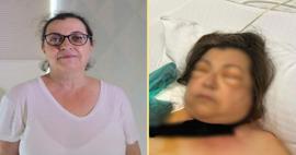 Türkiye'de ilk kez görüldü: Kusma sandı meğer soluk borusu yırtılmış!