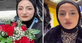 Estetik mağduru oldu! 'Amin Reis' lakaplı fenomen Gizem Yıldız'ın yüzü yandı